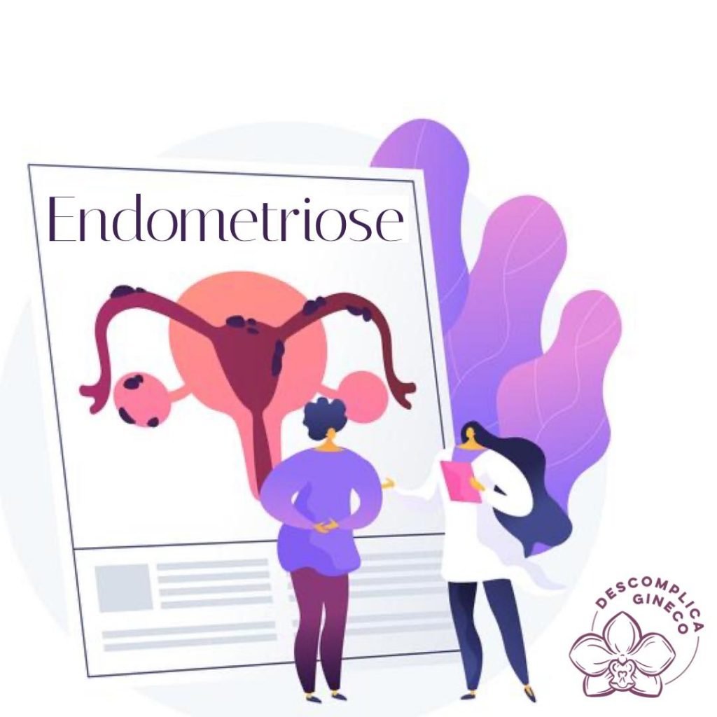 Entendendo melhor a Endometriose 1 WhatsApp Image 2021 07 14 at 13.14.50