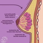 Se conheça melhor - anatomia das mamas 2 Anatomia das mamas 3