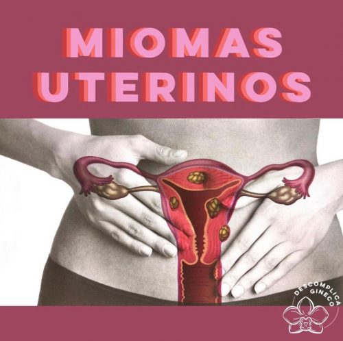 Capa Miomas Uterinos